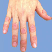 Human hand.